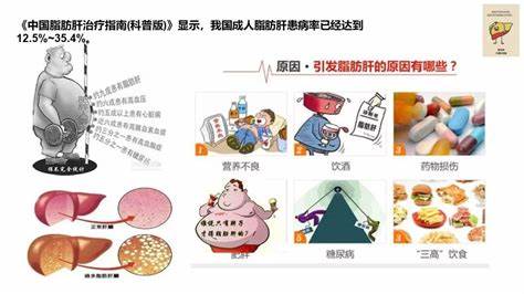 不胖但是有脂肪肝血脂高,健康人如何避免脂肪肝疾病