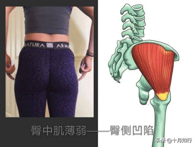 翘臀变平臀怎么练,屁股扁平塌陷怎么锻炼翘臀