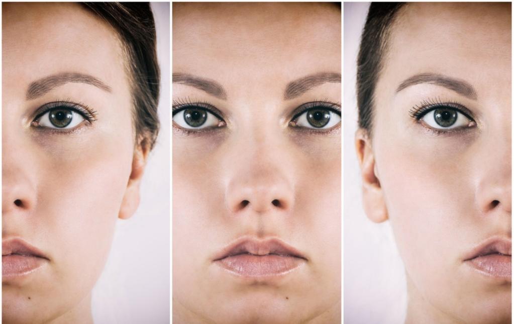 擦亮双眼：光电治疗、注射填充、化学剥脱你真的了解吗？