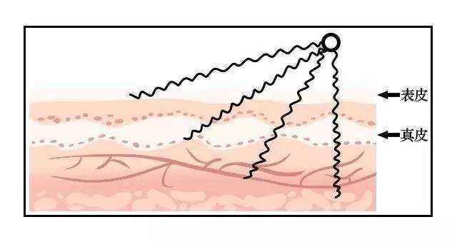 美容黑幕,美容仪内幕大揭秘