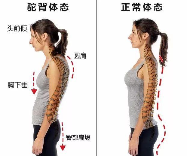 办公室综合征怎么处理,办公室综合征缓解方法