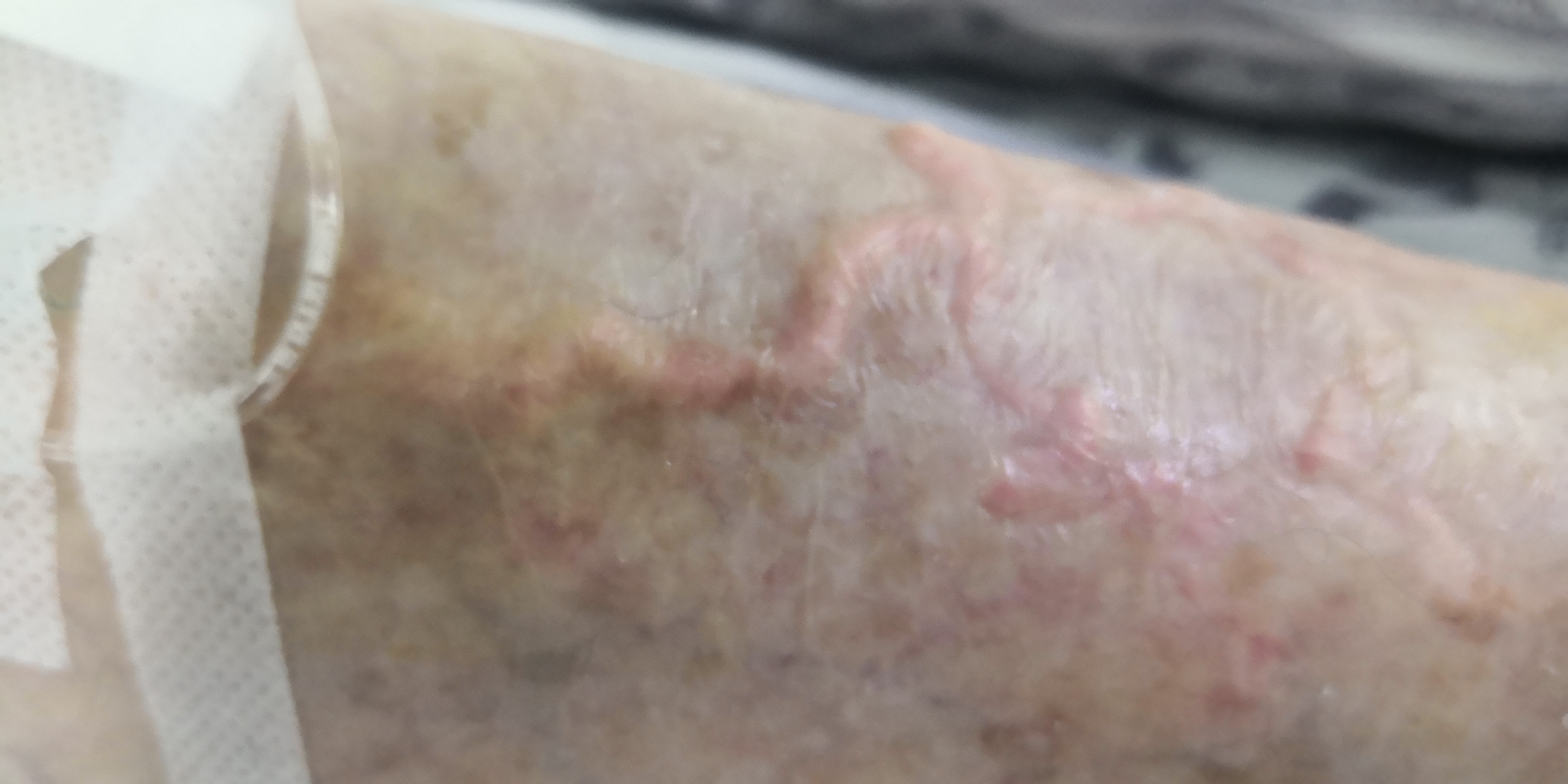 小腿老是发麻有沉重感看什么科,下肢腿部沉重是什么原因造成的