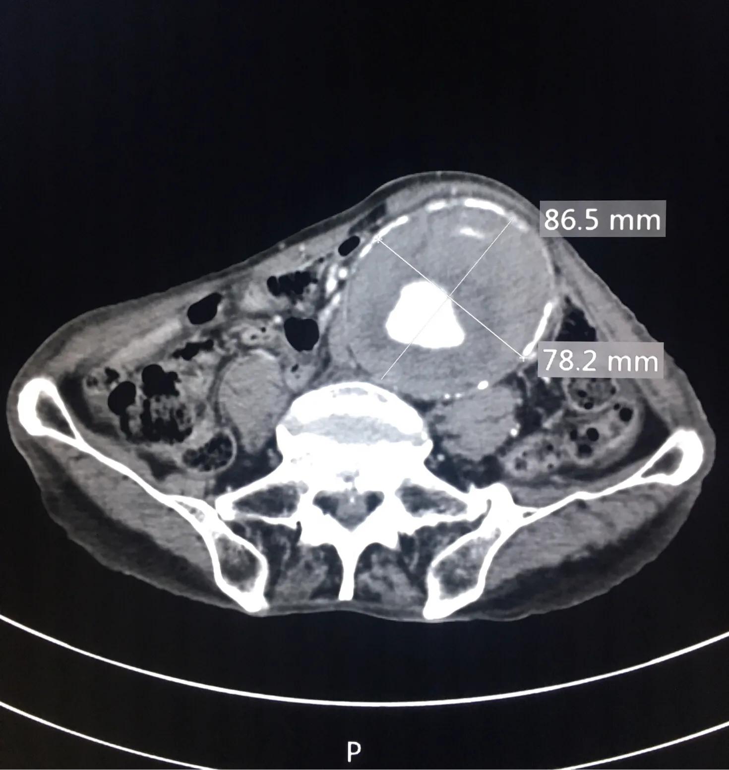 肚子疼要担心吗,肚子疼就是不来事儿