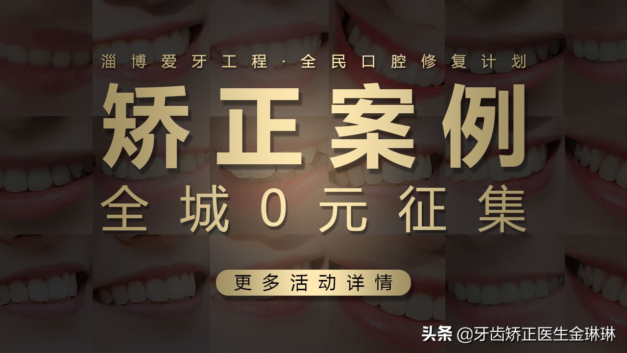 老虎牙可以戴牙套矫正吗,老虎牙做矫正