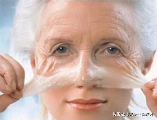 面部小拉皮手术提升效果和视频,面部提升手术和拉皮手术是一样吗