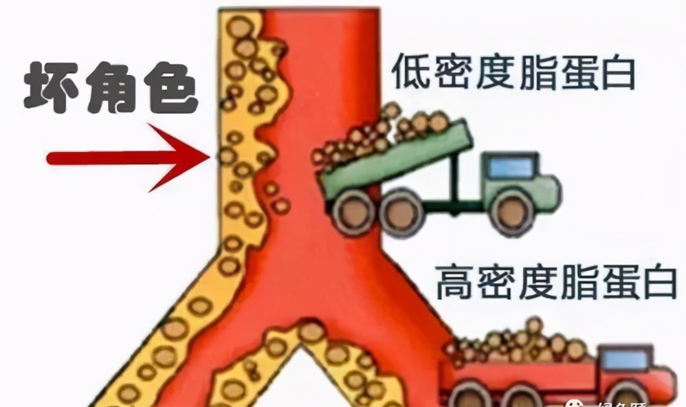 体检低密度脂蛋白胆固醇高怎么办,控制饮食可以降低低密度胆固醇吗