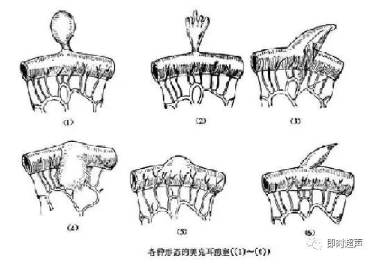 小儿消化道急症超声