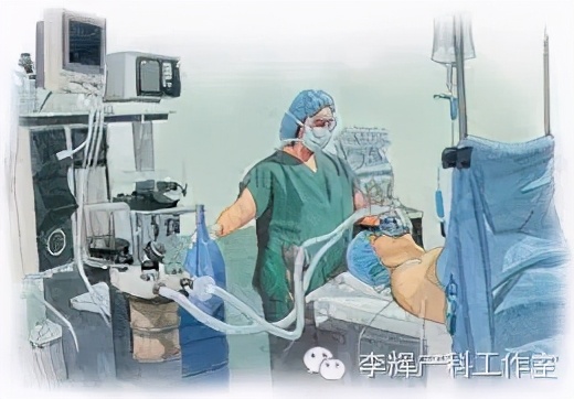 剖宫产憩室手术知情同意书,剖宫产手术同意书