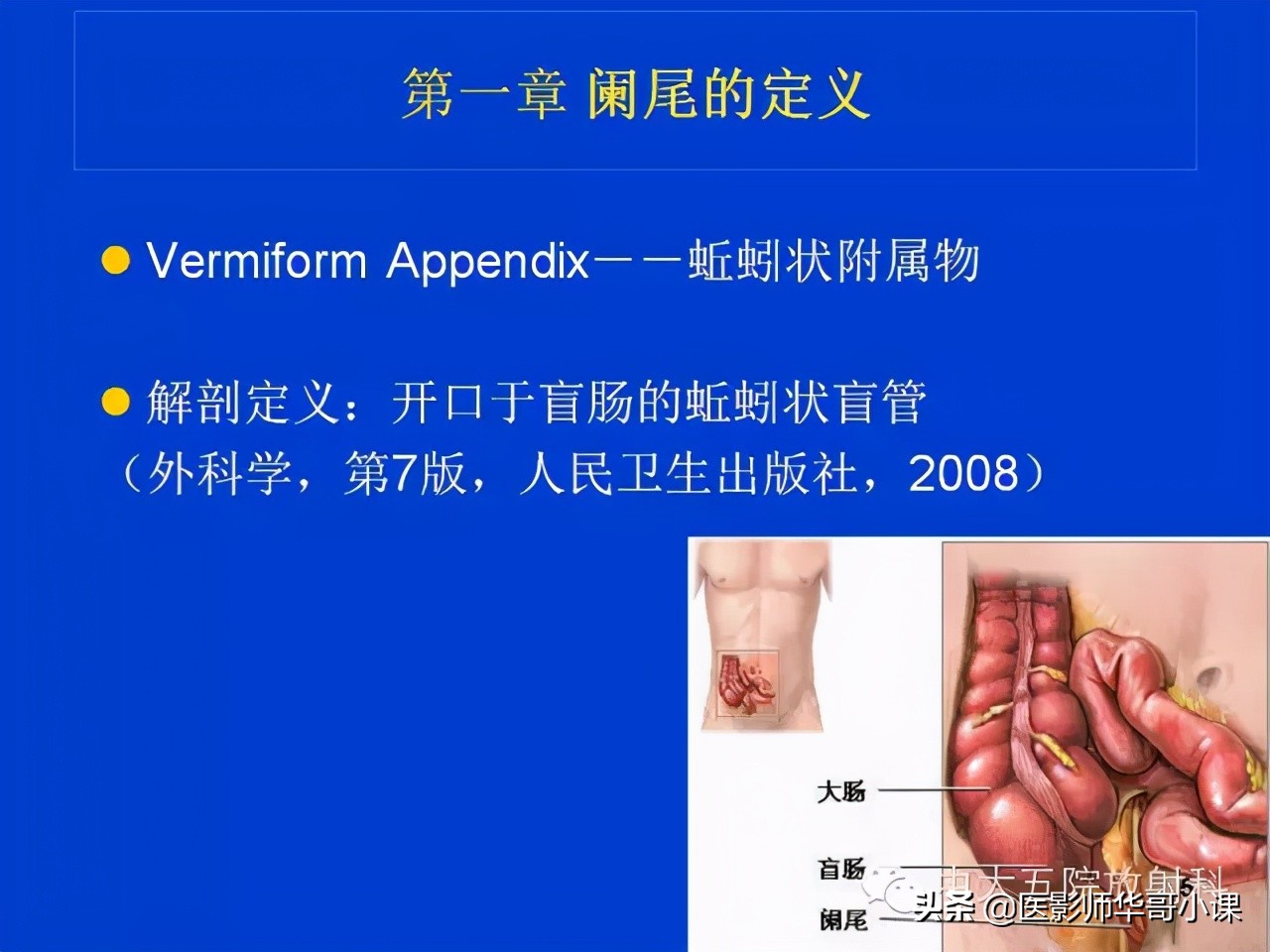 阑尾炎课件,阑尾炎的超声课件