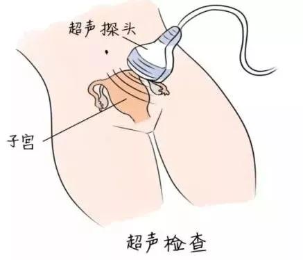 哈医大一院子宫肌瘤专家,子宫肌瘤疾病大全专家解析有声版
