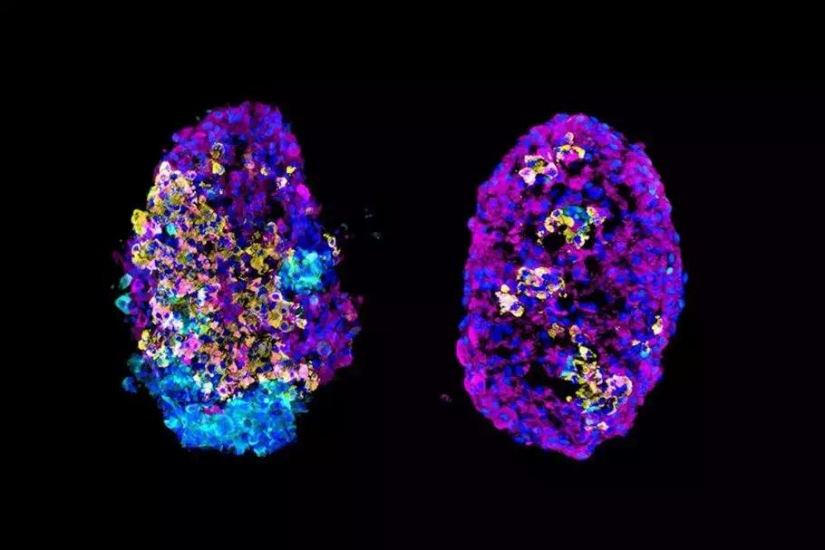 国外神经干细胞研究的最新进展,干细胞治愈糖尿病最新研究进展
