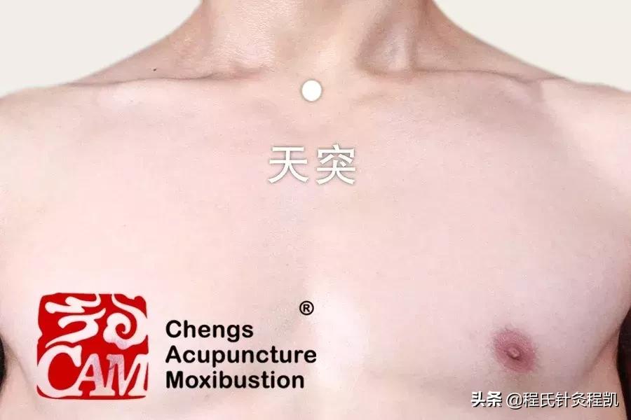 如何区分肺部和咽喉引起的咳嗽,病例咳嗽