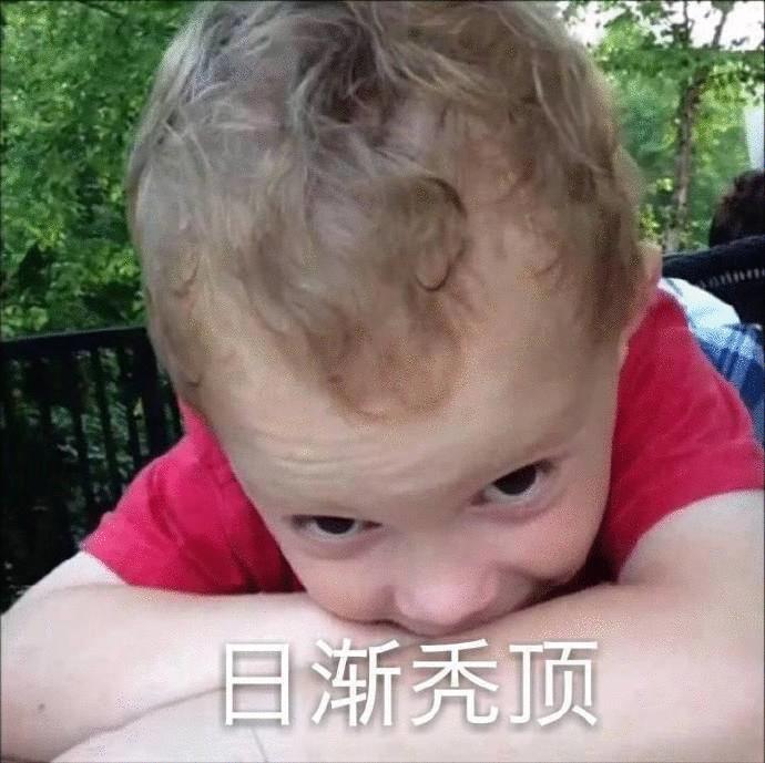 6岁女宝总是掉头发怎么回事,12岁女孩突然掉很多头发是为什么