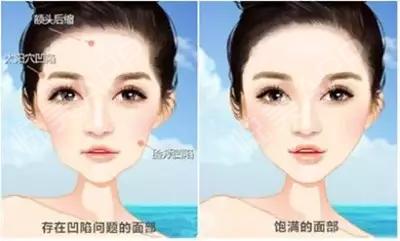 千万不要做减重手术,千万不要做自体脂肪填充