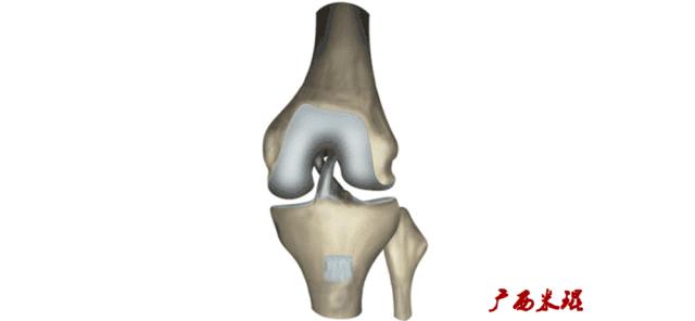 膝盖扭伤前交叉韧带损伤可以热敷,前交叉韧带扭伤最快自愈方法