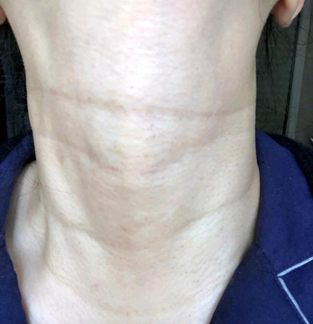 想拥有刘诗诗般的天鹅颈,刘诗诗谈天鹅颈怎样养成