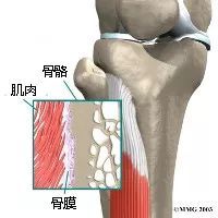 将近一半跑者都会遭遇的伤病,你中枪了吗?