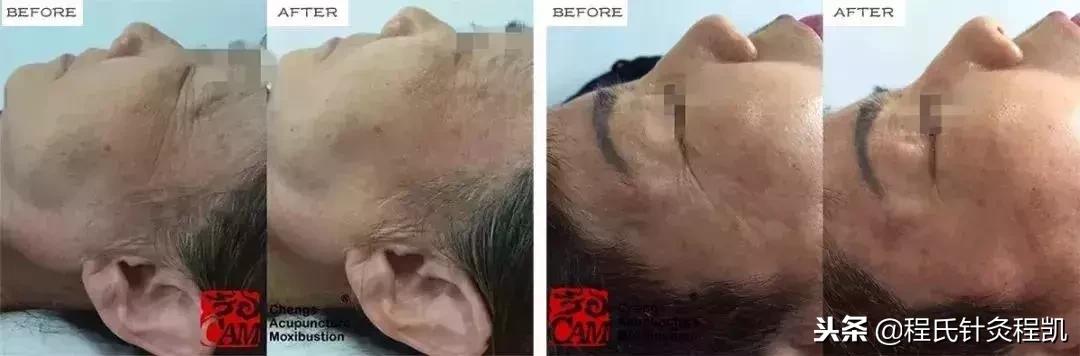 5个永不过时的美容妙招推荐,你需要尝试的10个惊人的美容技巧