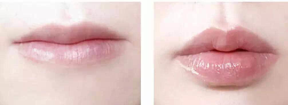 世界上最厚的嘴唇,世界上嘴唇最厚的人是谁