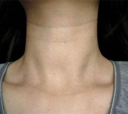 女人脖子三道杠预示什么,女人两眉间有两竖线有什么说法