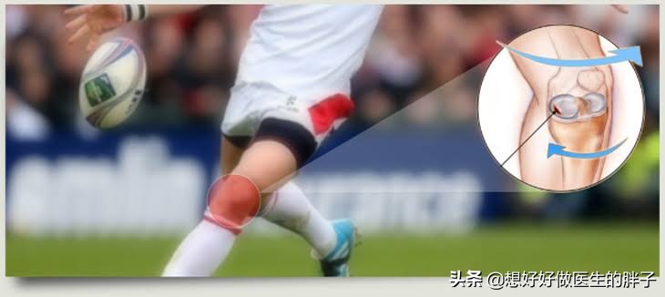 足球运动员有半月板问题吗,足球运动员为什么没有半月板