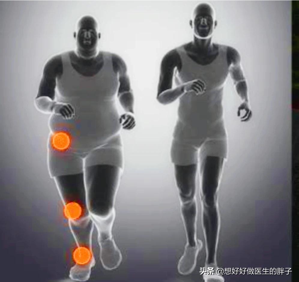 骨刺与骨性关节炎疼痛有什么区别,关节炎骨刺是怎么造成的