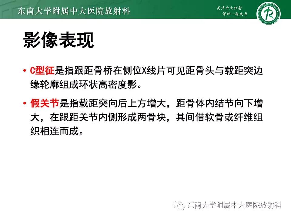 好文分享-《肌骨系统疾病——副舟骨综合征》