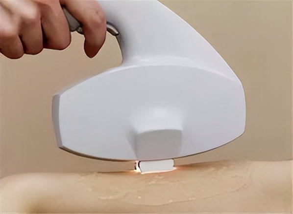 二极管激光脱毛,二极管招商信息