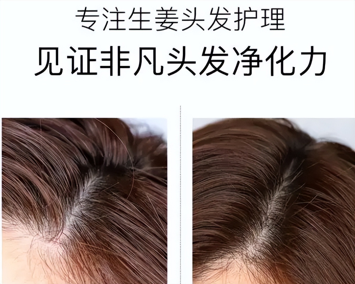 超市的洗发水有没有好推荐,超市洗发水推荐黑榜