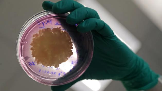 人造肉为什么比普通肉好吃,人造肉有什么特色