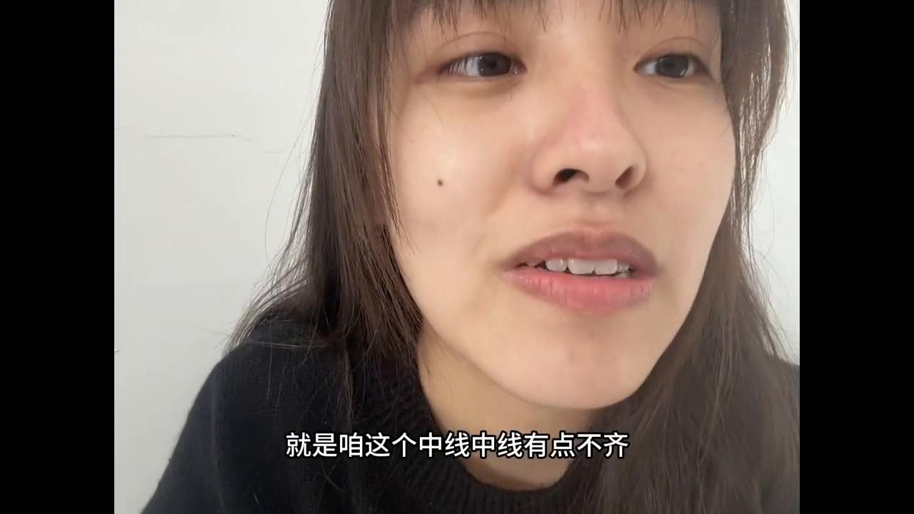 时隔两月终于给大家出这个牙齿视频了，好多人私信问我局部矫正