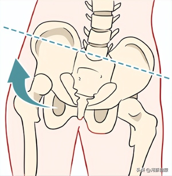 为什么不胖但是大腿特别粗,人不胖大腿粗是什么原因造成的