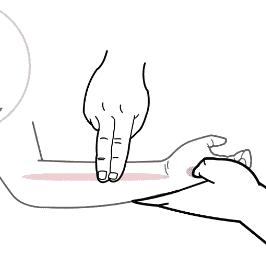 便秘不用愁舌象告诉你如何调理,便秘不吃药最快的一招通便