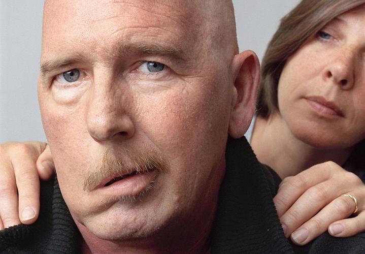 中医对中风的认知和康复方法,脑中风跟癫痫有什么区别