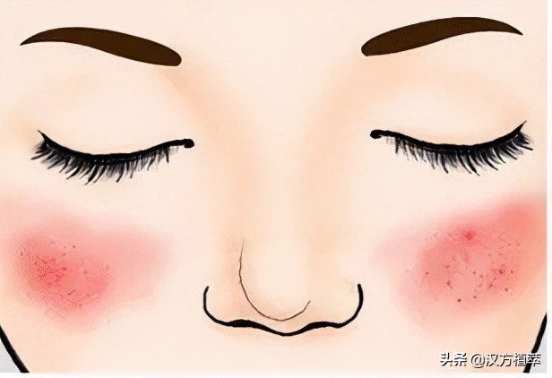 冬天来了皮肤红好痒,冬天来了脸上干燥