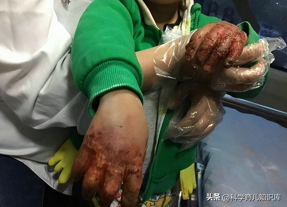 黑心后妈虐待孩子被保姆发现,继母虐待三岁女童