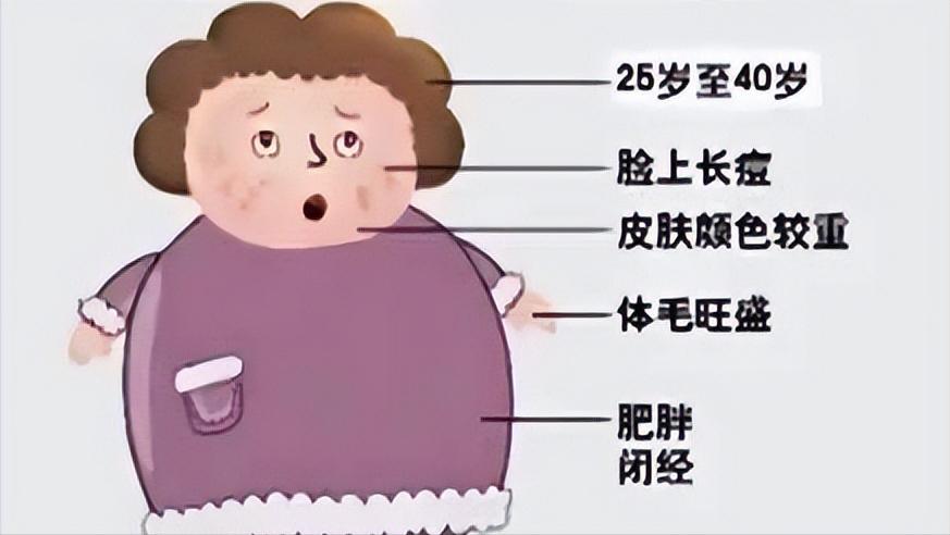 多囊巧克力囊肿,多囊和巧克力囊肿的区别