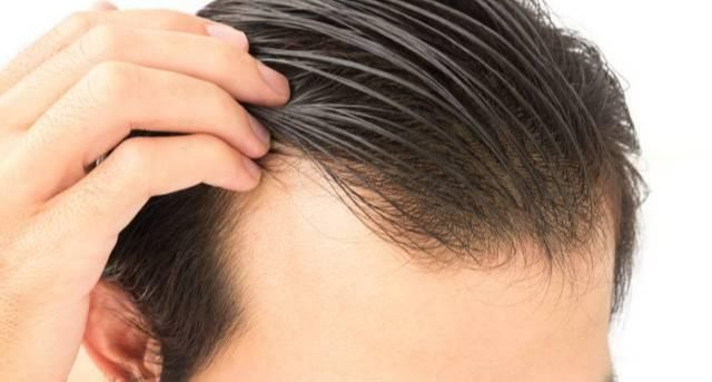 防脱发固发的洗发水哪种好,固发防脱发用什么洗发水