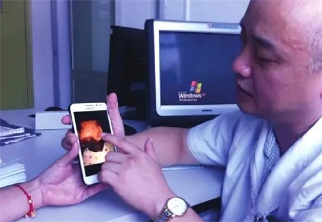 刚出生的小孩长满了黑斑,刚出生小孩皮肤黑斑