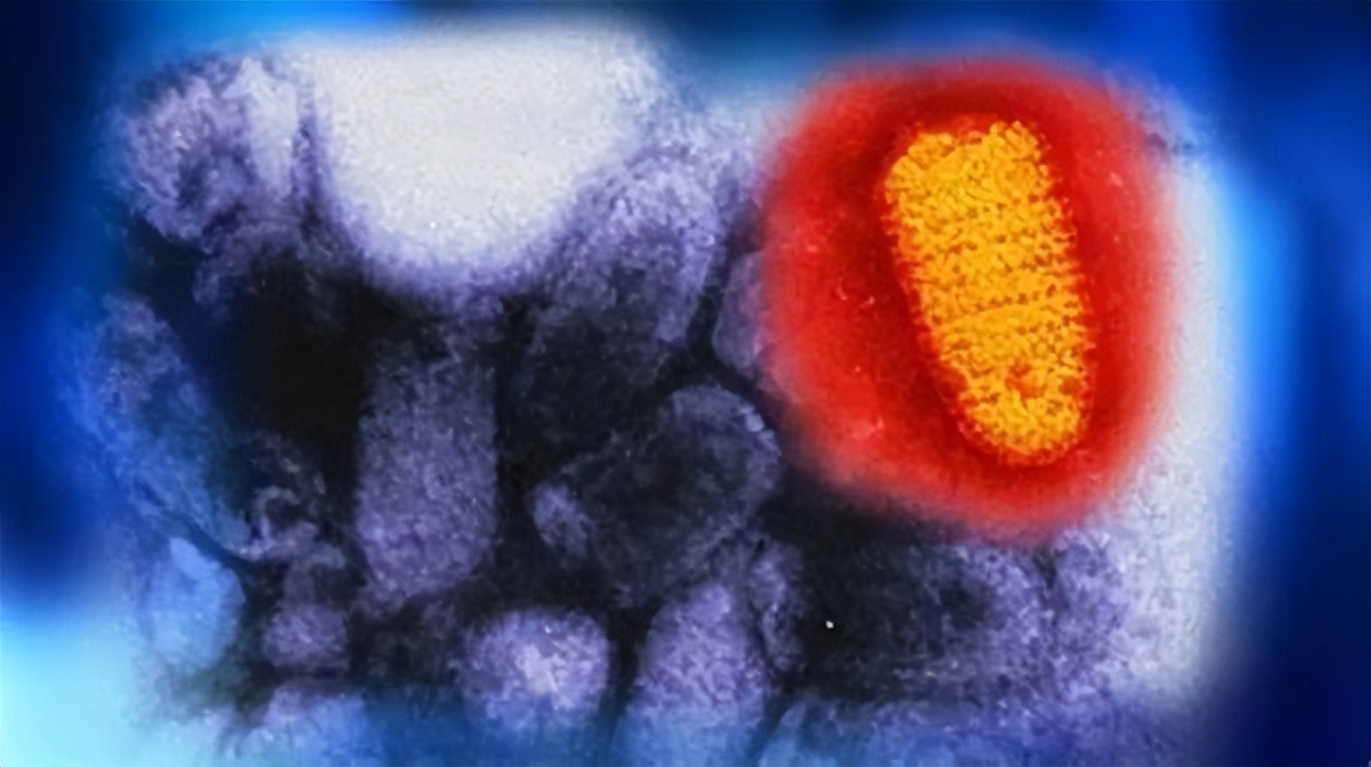 致死率近100%狂犬病为何如此恐怖,科普篇狂犬病到底有多可怕