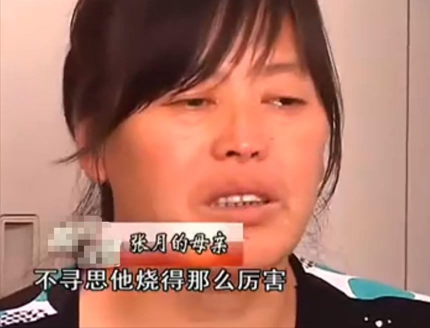 20岁小伙被重度烧伤七年后续,山东男子下肢被烧伤