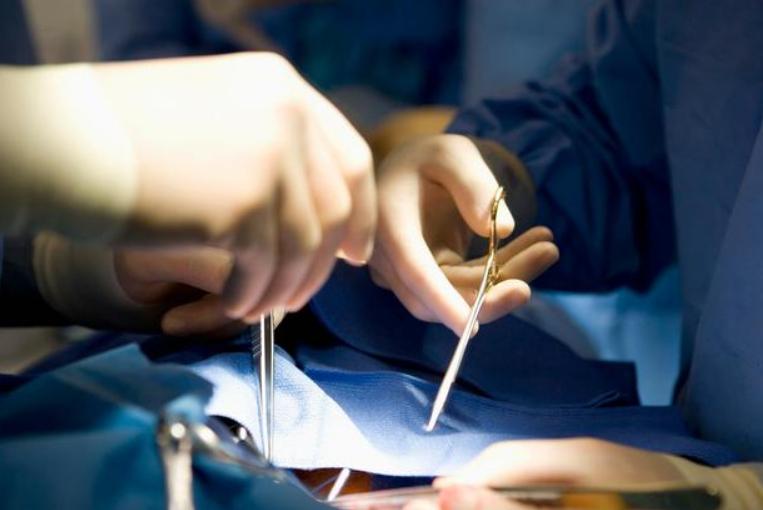 结扎避孕概率,结扎是最好的避孕方法吗