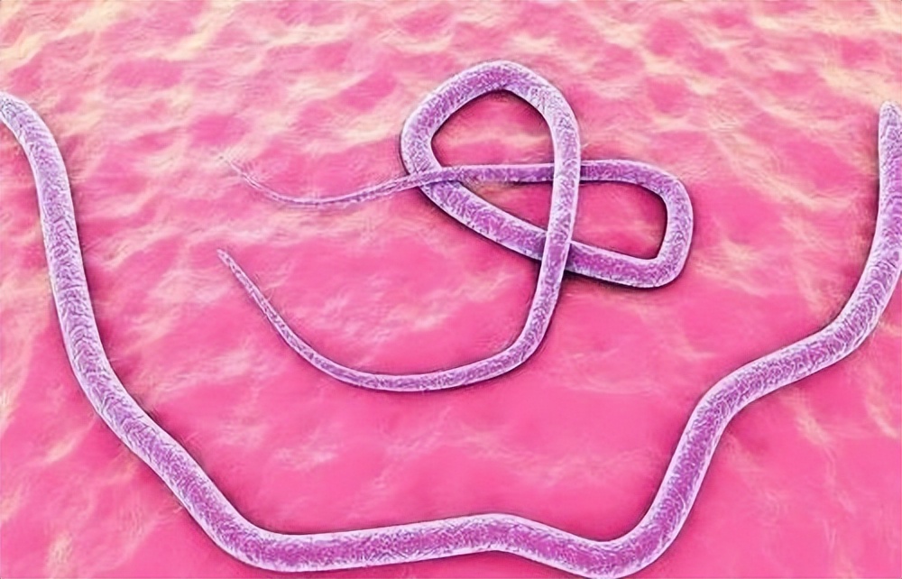 警惕食物寄生虫感染听听专家建议,5种食物易含寄生虫最好不要生吃