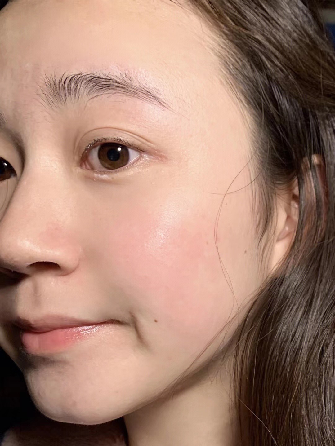 如何祛痘印最有效简单方法,皮肤科推荐淡化痘印收缩毛孔