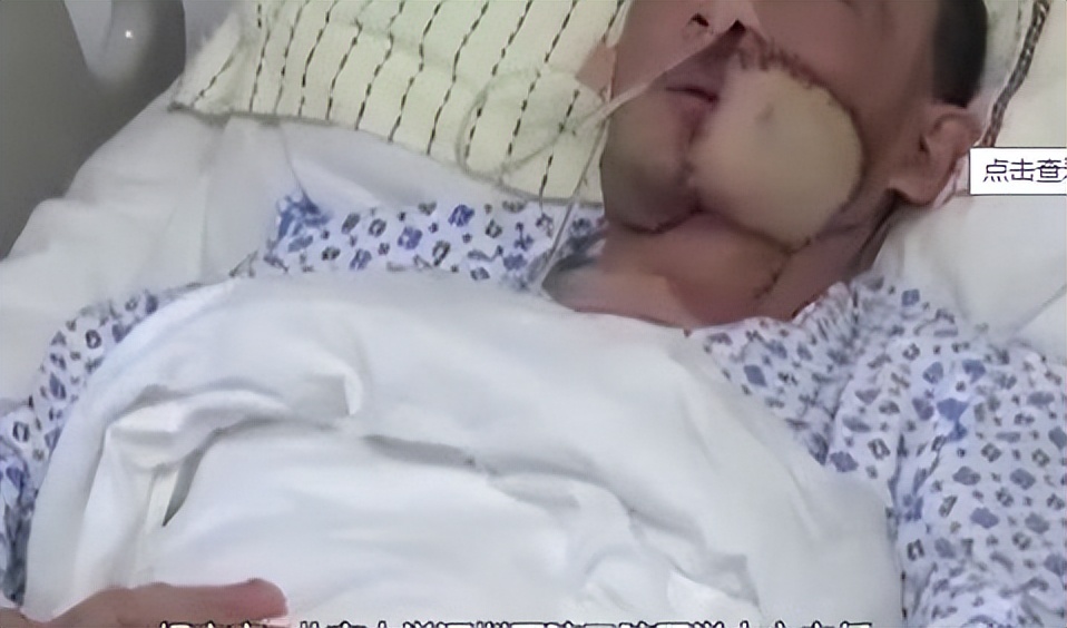 小孩吃槟榔有什么危害,中药槟榔长期吃有危害吗