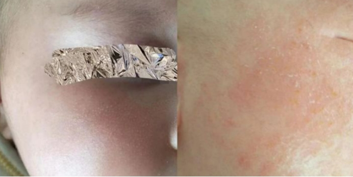 含有激素的面霜有哪些品牌,含激素面霜推荐