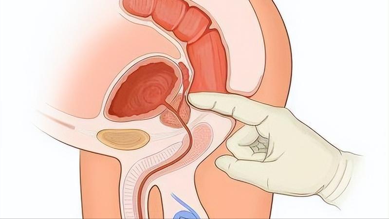 单身女子提醒:女性做妇科体检前，一定要禁欲，否则会非常尴尬