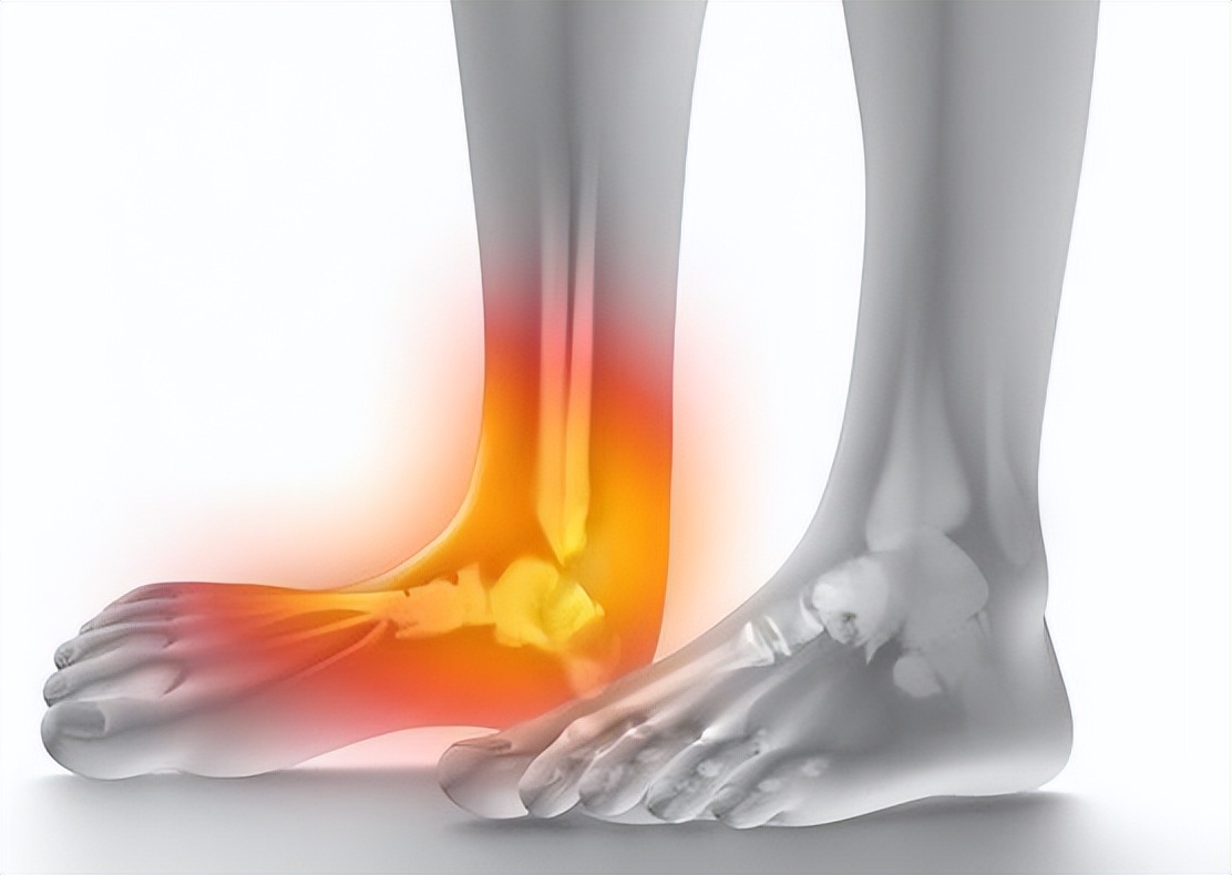 脚趾骨折断端稍分离移位,判断脚趾是骨折还是损伤的方法