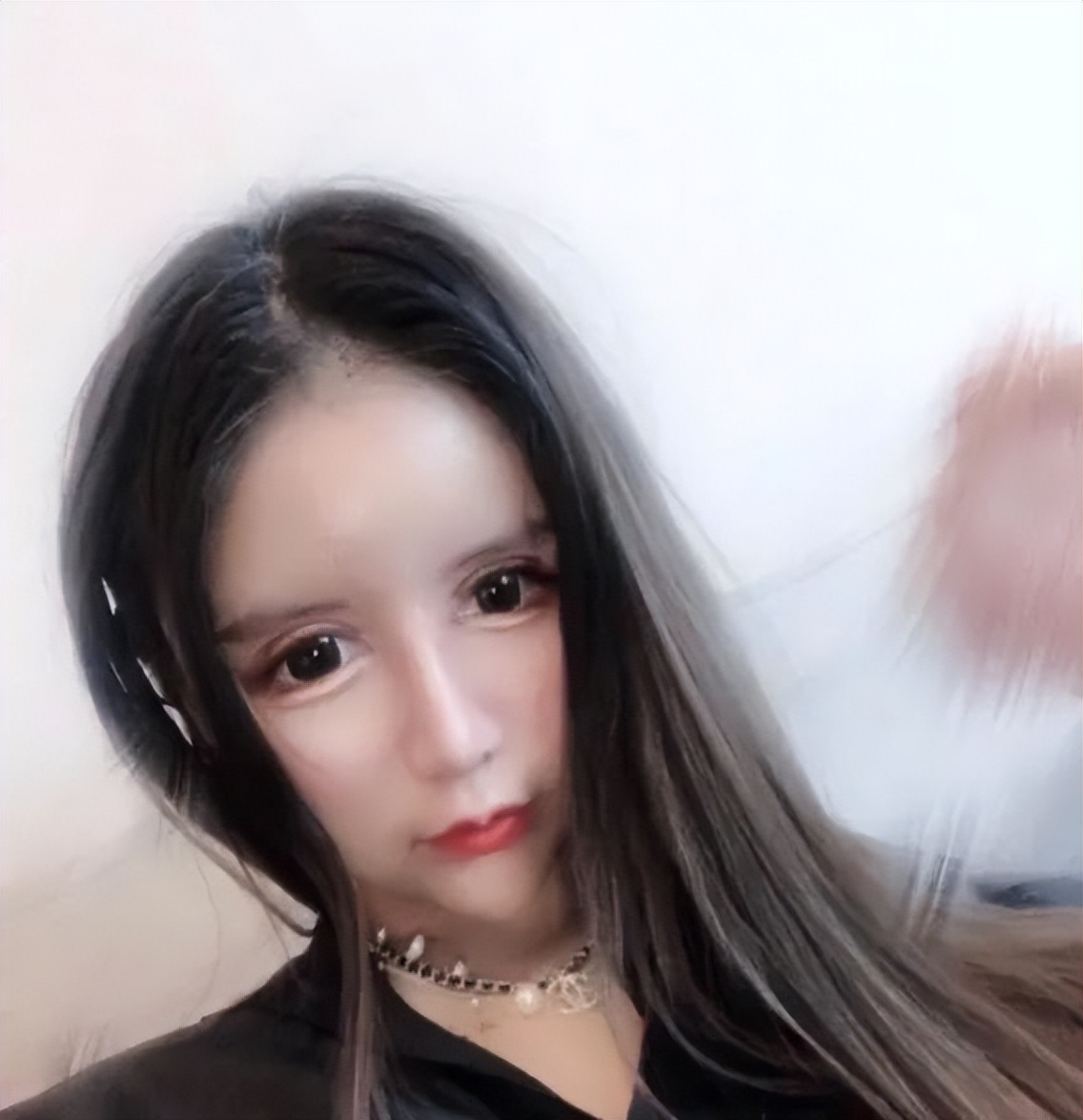 15岁网红自曝整形超100次，后遗症记忆力衰退，换脸停不下来