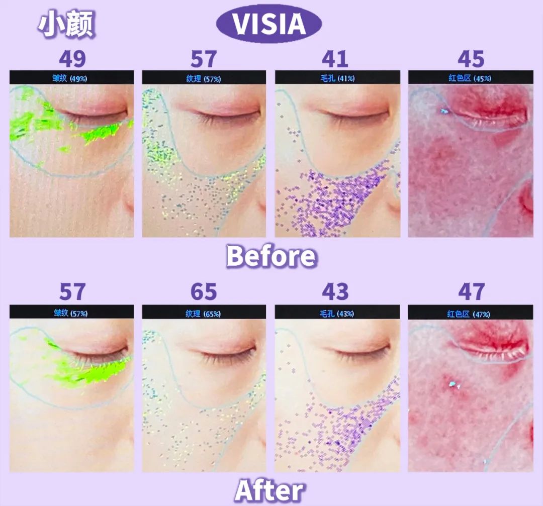 美肌抗老,城野医生169抗老精华测评